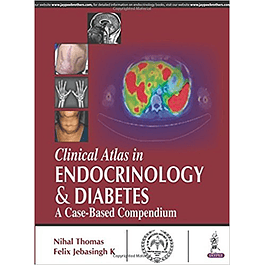 Clinical Atlas in Endocrinology and Diabetes: A Case-Based Compendium