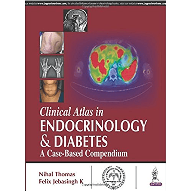 Clinical Atlas in Endocrinology and Diabetes: A Case-Based Compendium
