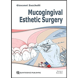  Mucogingival Esthetic Surgery