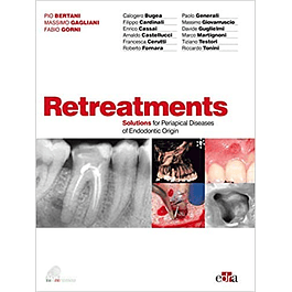 Retreatments: Solutions for Periapical Diseases of Endodontic Origin