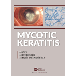 Mycotic Keratitis