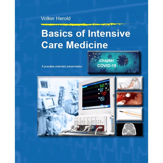 Basics of Intensive Care Medicine 