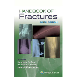 Handbook of Fractures