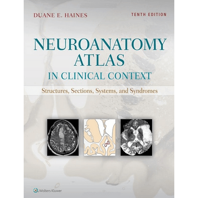 Neuroanatomy Atlas in Clinical Context: Structures, Sections, Systems, and Syndromes