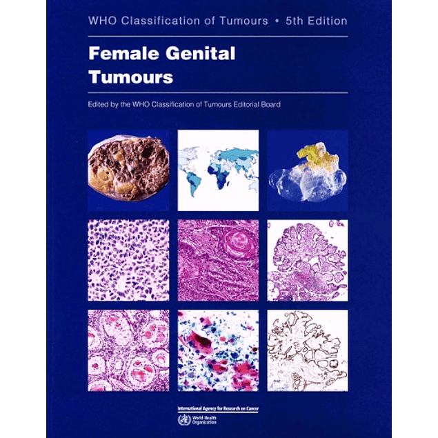 Female Genital Tumours: WHO Classification of Tumours