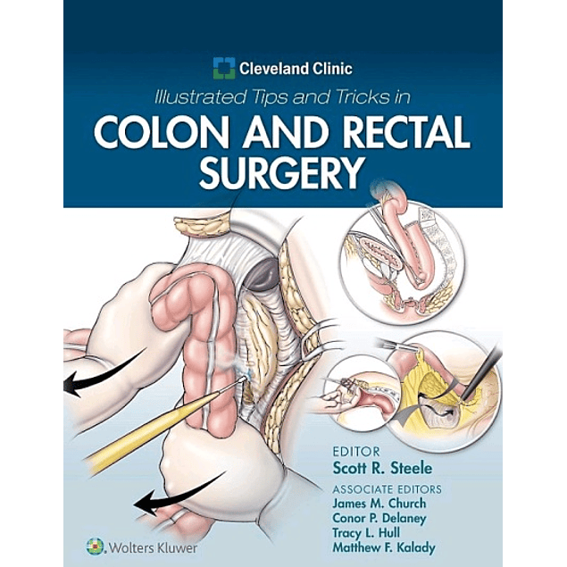 Cleveland Clinic Illustrated Tips and Tricks in Colon and Rectal Surgery