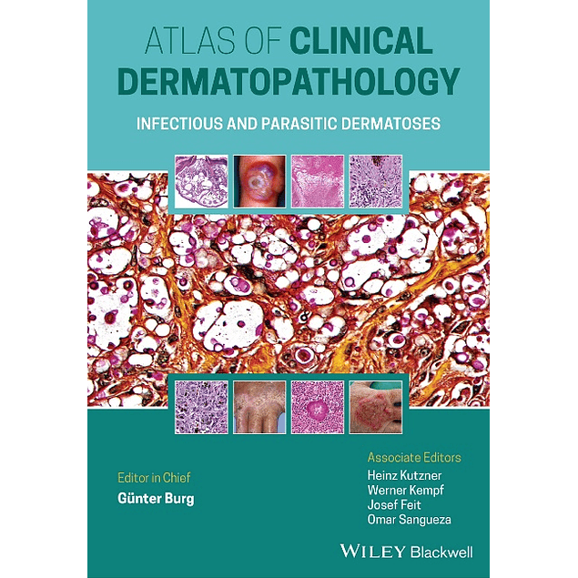 Atlas of Clinical Dermatopathology: Infectious and Parasitic Dermatoses