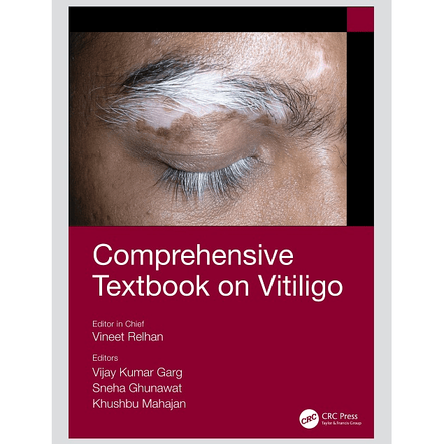 Comprehensive Textbook on Vitiligo