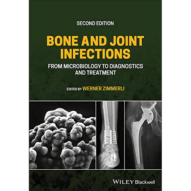 Bone and Joint Infections: From Microbiology to Diagnostics and Treatment
