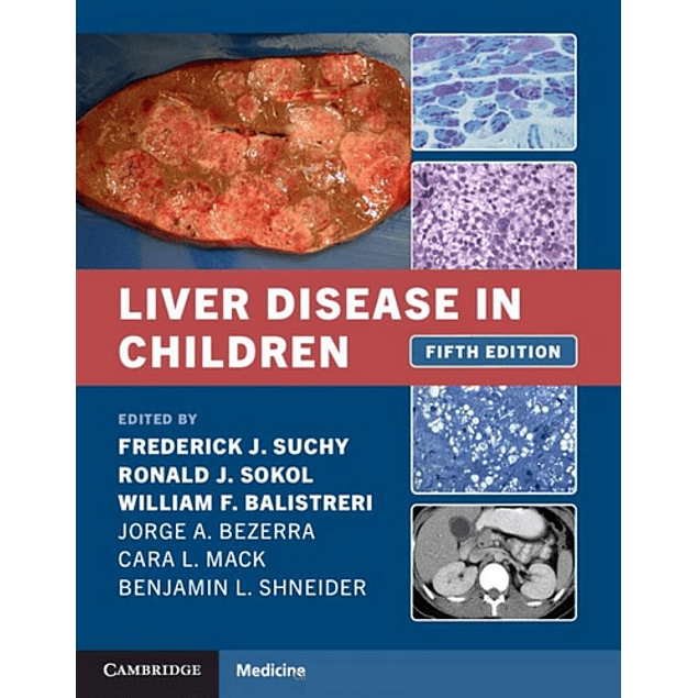  Liver Disease in Children