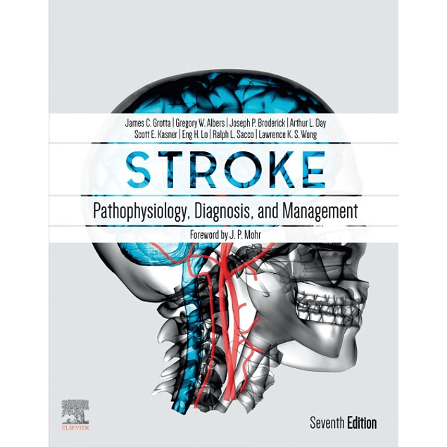 Stroke: Pathophysiology, Diagnosis, and Management