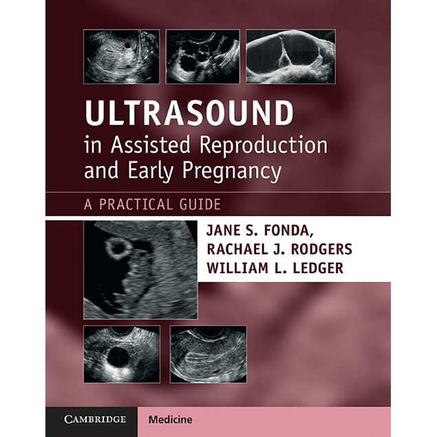 Ultrasound in Assisted Reproduction and Early Pregnancy: A Practical Guide