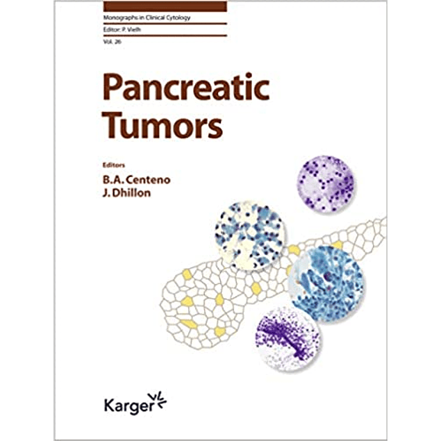 Pancreatic Tumors