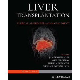 Liver Transplantation: Clinical Assessment and Management