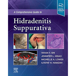 A Comprehensive Guide to Hidradenitis Suppurativa
