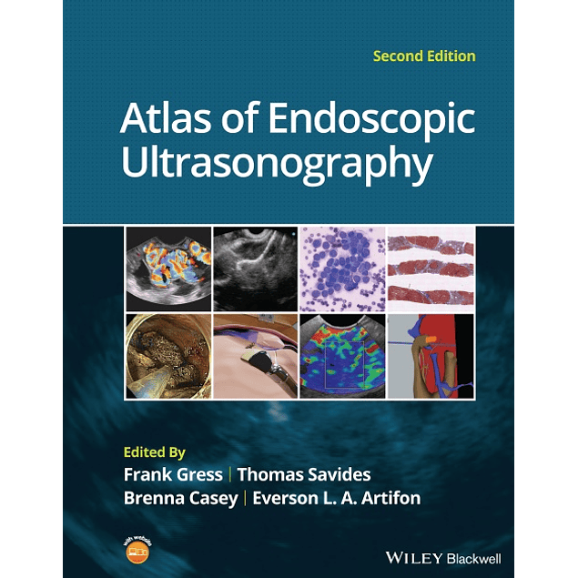 Atlas of Endoscopic Ultrasonography