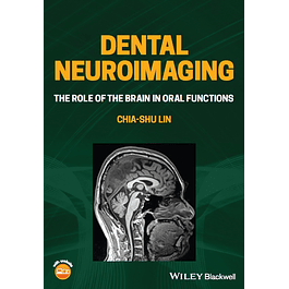 Dental Neuroimaging: The Role of the Brain in Oral Functions