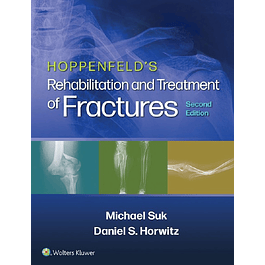 Hoppenfeld's Treatment and Rehabilitation of Fractures 