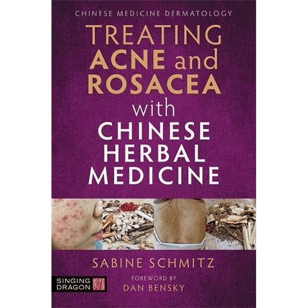 Treating Acne and Rosacea With Chinese Herbal Medicine 
