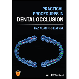 Practical Procedures in Dental Occlusion