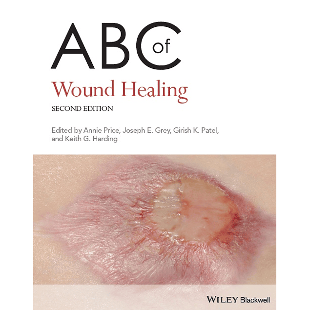 ABC of Wound Healing 