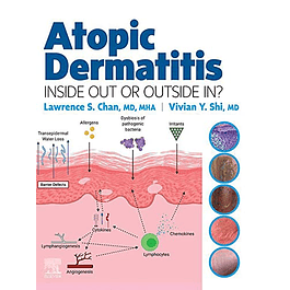 Atopic Dermatitis: Inside Out or Outside In