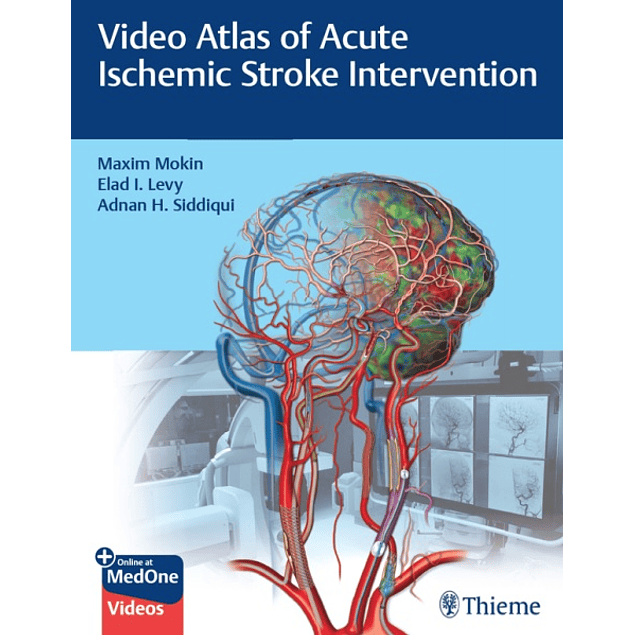 Video Atlas of Acute Ischemic Stroke Intervention