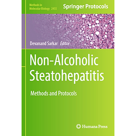 Non-Alcoholic Steatohepatitis: Methods and Protocols