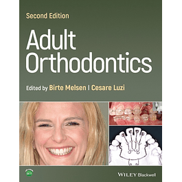 Adult Orthodontics