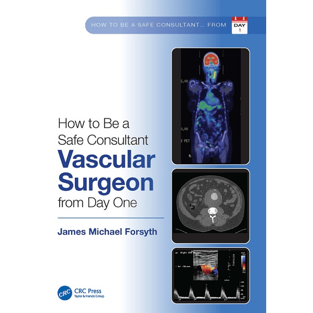 How to be a Safe Consultant Vascular Surgeon from Day One