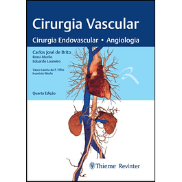 Cirurgia Vascular: Cirurgia Endovascular . Angiologia 