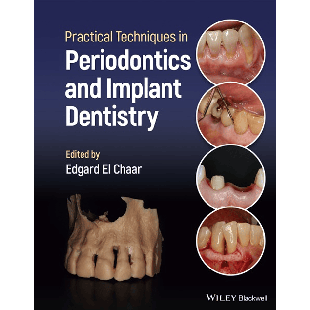  Practical Techniques in Periodontics and Implant Dentistry 