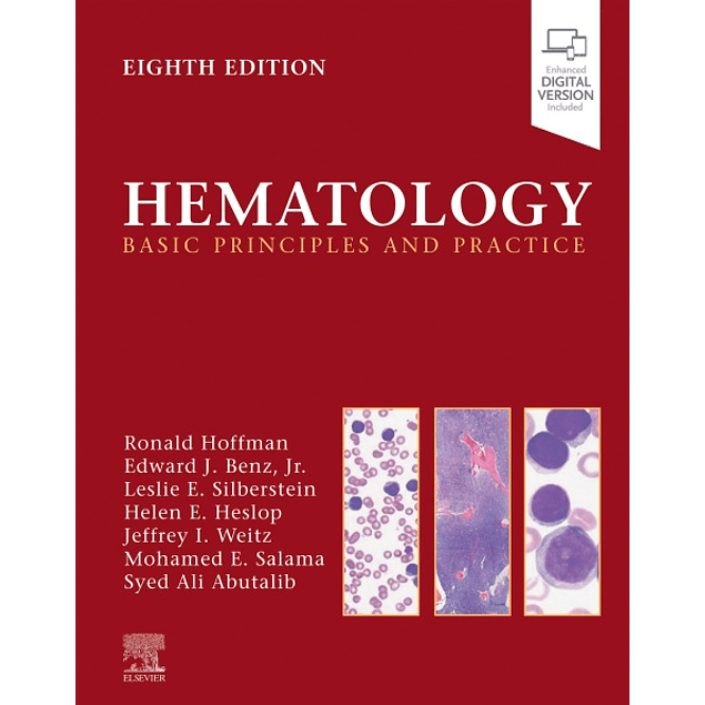 Hematology: Basic Principles and Practice 