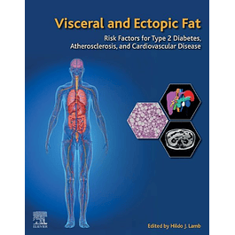 Visceral and Ectopic Fat: Risk Factors for Type 2 Diabetes, Atherosclerosis, and Cardiovascular Disease