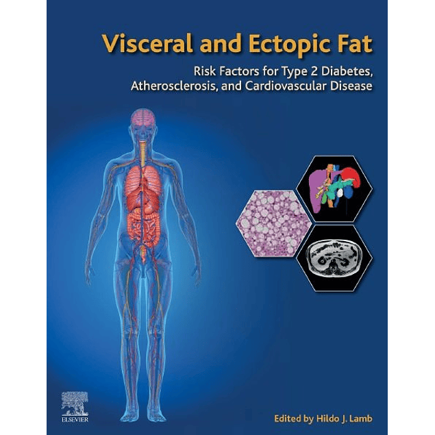 Visceral and Ectopic Fat: Risk Factors for Type 2 Diabetes, Atherosclerosis, and Cardiovascular Disease