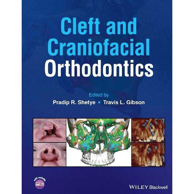 Cleft and Craniofacial Orthodontics 