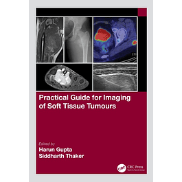 Practical Guide for Imaging of Soft Tissue Tumours