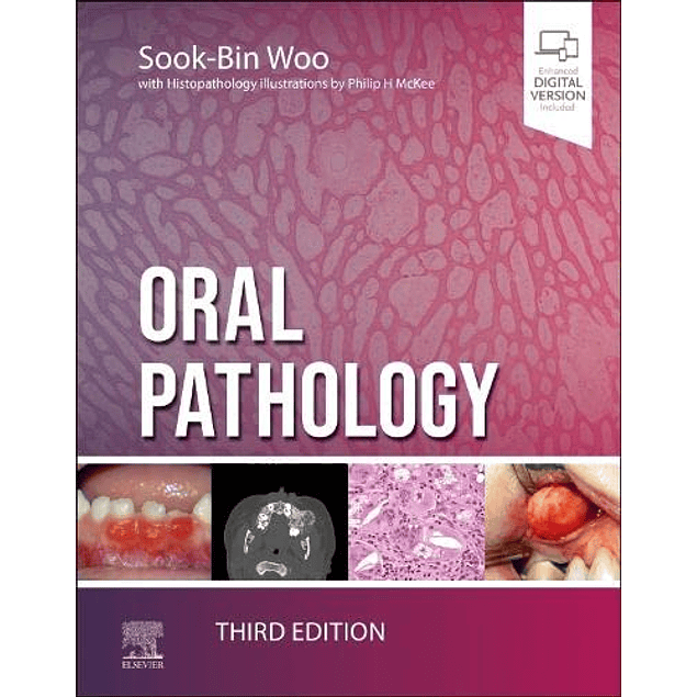 Oral Pathology