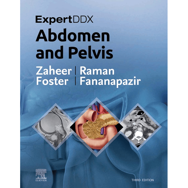 ExpertDDx: Abdomen and Pelvis