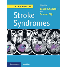 Stroke syndromes