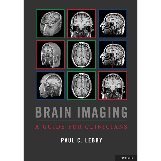 Brain Imaging: A Guide for Clinicians