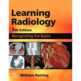 Learning Radiology: Recognizing the Basics