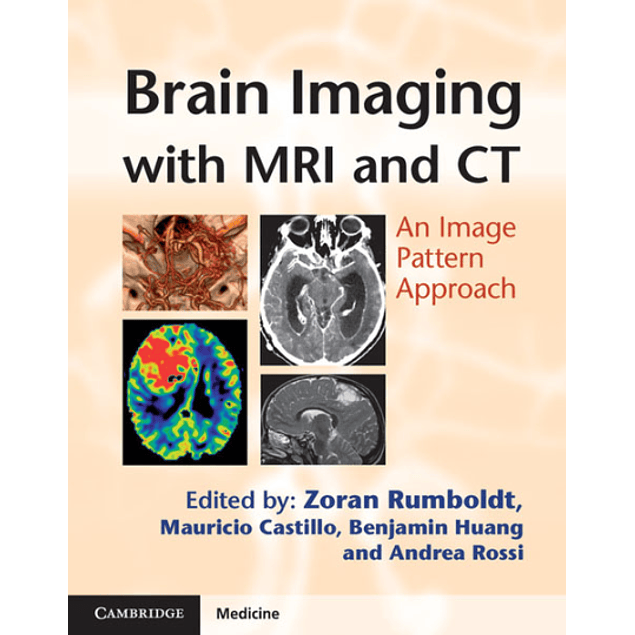  Brain Imaging with MRI and CT: An Image Pattern Approach 