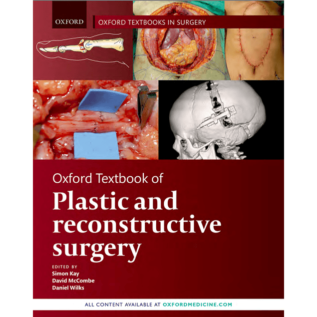 Oxford Textbook of Plastic and Reconstructive Surgery