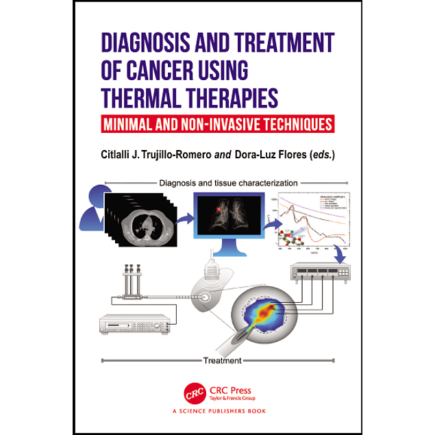 Diagnosis and Treatment of Cancer using Thermal Therapies: Minimal and Non-invasive Techniques 