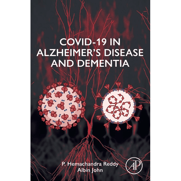 COVID-19 in Alzheimer's Disease and Dementia 