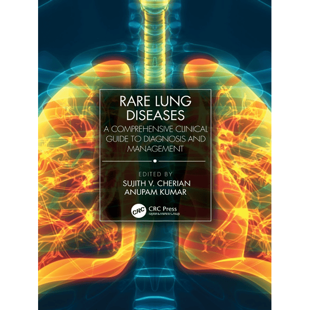 Rare Lung Diseases: A Comprehensive Clinical Guide to Diagnosis and Management