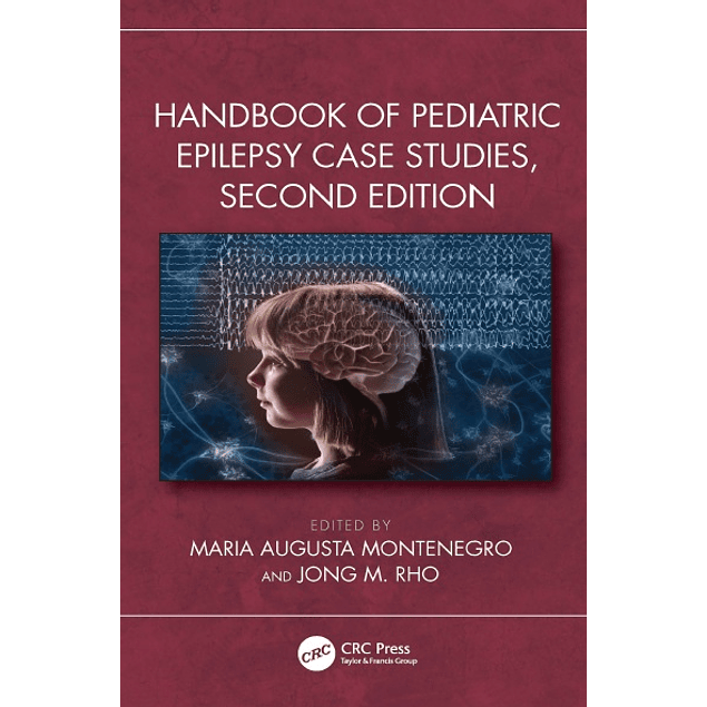 Handbook of Pediatric Epilepsy Case Studies, Second Edition 2nd Edition