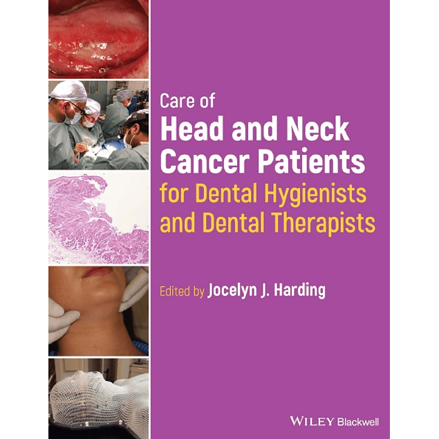 Care of Head and Neck Cancer Patients for Dental Hygienists and Dental Therapists