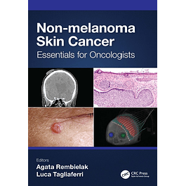 Non-melanoma Skin Cancer: Essentials for Oncologists